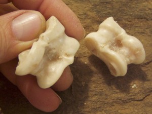 Astragalus Bones
